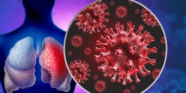 الالتهاب الرئوي علامات الإصابة بفتاك الهواء