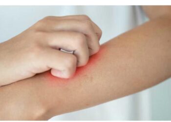 متى تحتاج إلى طبيب بسبب طفح جلدي؟