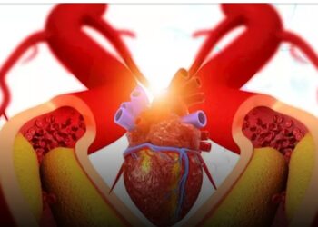 كيف تواجه انسداد شرايين القلب .. إليك الأعراض