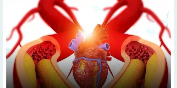 كيف تواجه انسداد شرايين القلب .. إليك الأعراض