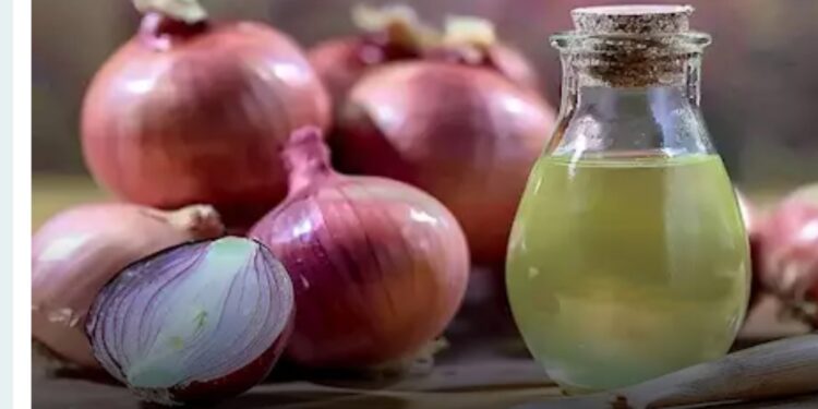 البصل علاج طبيعي لتساقط الشعر: حقيقة أم خرافة؟