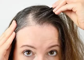 الشعر الأبيض