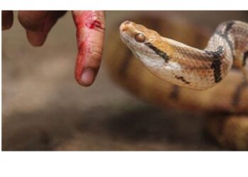 رجل يحقن نفسه بسم الثعبان 856 مرة .. ما القصة؟