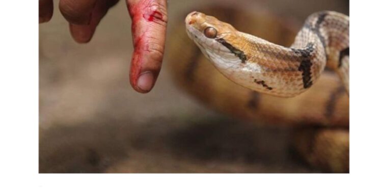 رجل يحقن نفسه بسم الثعبان 856 مرة .. ما القصة؟