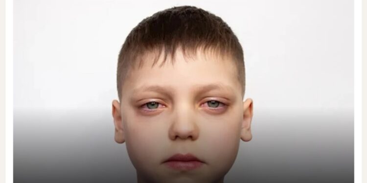 الهالات السوداء عند الأطفال: الأسباب وطرق العلاج