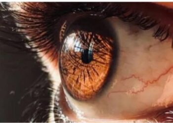 أفضل الطرق لحماية الشعر من أضرار مياه البحر خلال المصيف