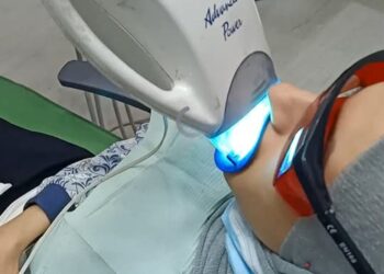 أفضل أنواع العلاج لالتهاب اللثة وحرقان الأسنان