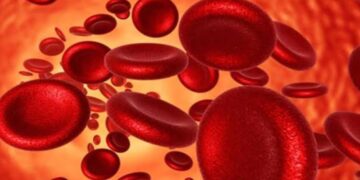 أفضل الأطعمة لعلاج نقص الحديد وتعزيز الصحة