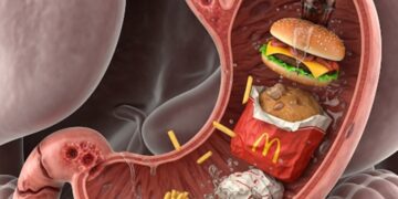 الوجبات السريعة: هل تدفع الثمن من صحة جهازك الهضمي؟