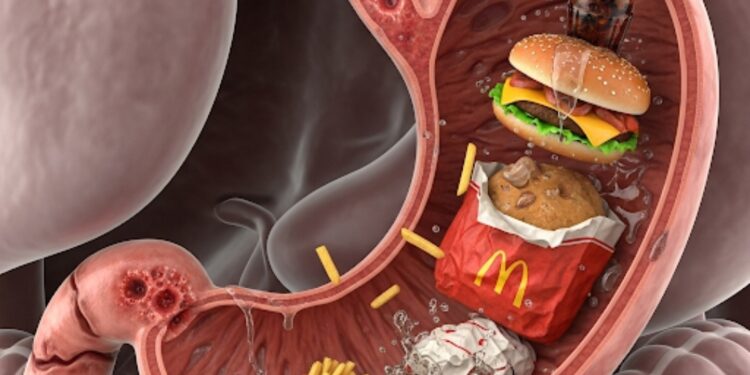 الوجبات السريعة: هل تدفع الثمن من صحة جهازك الهضمي؟